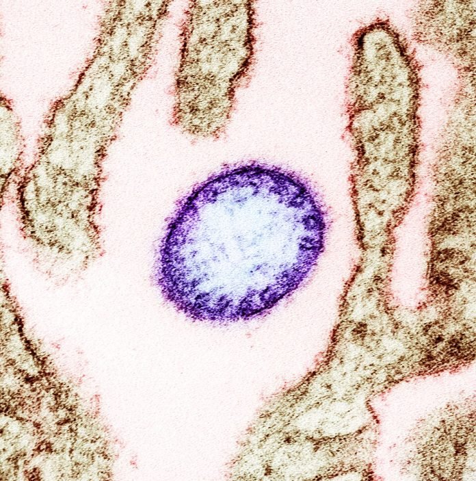 Nipah_virus_from_an_infected_VERO_cell