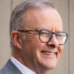 Anthony Albanese
